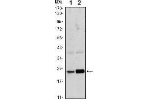 Western blot analysis using Rab10 mouse mAb against Hela (1) and NIH/3T3 (2) cell lysate. (RAB10 antibody)