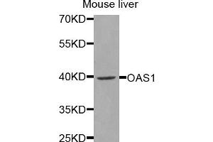 Western blot analysis of extracts of mouse liver, using OAS1 antibody (ABIN5971361) at 1/1000 dilution. (OAS1 antibody)
