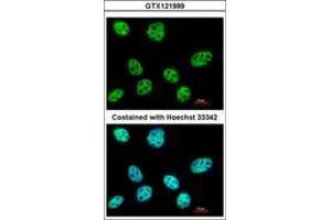 Image no. 2 for anti-Polymerase (RNA) III (DNA Directed) Polypeptide E (80kD) (POLR3E) (AA 89-323) antibody (ABIN1500341) (POLR3E antibody  (AA 89-323))