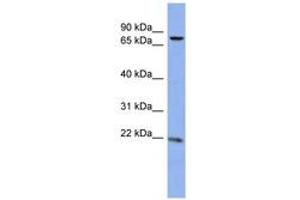 Image no. 1 for anti-Zinc Finger Protein 530 (ZNF530) (N-Term) antibody (ABIN6742860) (ZNF530 antibody  (N-Term))