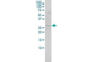 SH3BGR monoclonal antibody (M01), clone 3B7 Western Blot analysis of SH3BGR expression in Hela . (SH3BGR antibody  (AA 1-239))