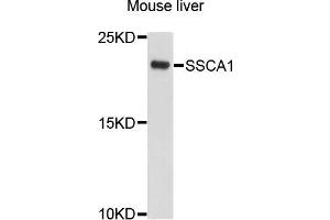 Western blot analysis of extracts of mouse liver cells, using SSSCA1 antibody.