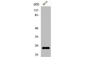 Western Blot analysis of COLO205 cells using Ephrin-A2 Polyclonal Antibody