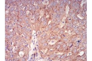 Immunohistochemistry (IHC) image for anti-RAB6B, Member RAS Oncogene Family (RAB6B) (AA 95-208) antibody (ABIN5542692)