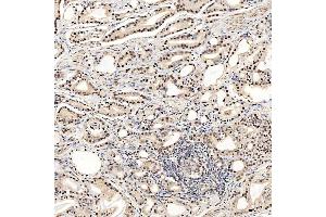 IHC analysis of SNRNP27 using anti-SNRNP27 antibody (ABIN7599614). (SNRNP27 antibody  (AA 100-155))