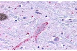 Immunohistochemical (Formalin/PFA-fixed paraffin-embedded sections) staining in human brain, neurons and glia with MRGF polyclonal antibody . (Mrgprf antibody  (C-Term))