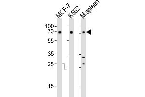 Western blot analysis of lysates from MCF-7, K562 cell line and mouse spleen tissue(from left to right), using RBBP5 Antibody (C-term) (ABIN6242596 and ABIN6577711). (RBBP5 antibody  (C-Term))