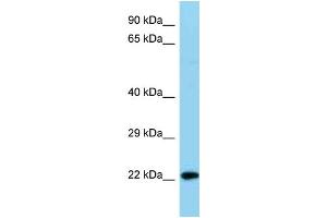WB Suggested Anti-Ndufb8 Antibody   Titration: 1. (NDUFB8 antibody  (C-Term))