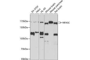 Western blot analysis of extracts of various cell lines, using NFASC antibody (ABIN3017266, ABIN3017267, ABIN3017268 and ABIN6220017) at 1:1000 dilution.
