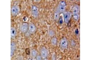 #VALUE! (CILP antibody  (AA 604-864))