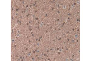 Used in DAB staining on fromalin fixed paraffin- embedded brain tissue (BCOR antibody  (AA 1501-1755))