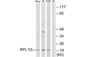 Western Blotting (WB) image for anti-Ribosomal Protein L10L (RPL10L) (C-Term) antibody (ABIN1850609) (RPL10L antibody  (C-Term))