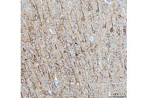 IHC analysis of Alpha Internexin using anti-Alpha Internexin antibody (ABIN4886634). (INA antibody  (AA 71-161))