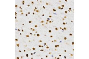 Immunohistochemistry of paraffin-embedded rat brain using DiMethyl-Histone H3-K9 antibody (ABIN1872998) at dilution of 1:200 (40x lens). (Histone 3 antibody  (H3K9me2))