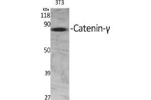 Western Blot analysis of various cells using Catenin-γ Polyclonal Antibody diluted at 1:2000. (JUP antibody  (AA 670-750))