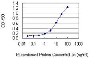 Detection limit for recombinant GST tagged SLC22A4 is 0. (SLC22A4 antibody  (AA 43-141))