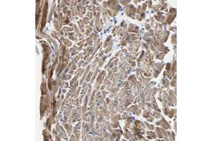 Immunohistochemical staining of human heart with NCAPH polyclonal antibody  shows strong cytoplasmic positivity in myocytes at 1:50-1:200 dilution. (NCAPH antibody)