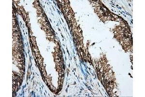 Immunohistochemical staining of paraffin-embedded Kidney tissue using anti-BSG mouse monoclonal antibody. (CD147 antibody)