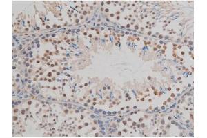 ABIN6267377 at 1/200 staining Mouse testis tissue sections by IHC-P. (GFAP antibody  (pSer38))