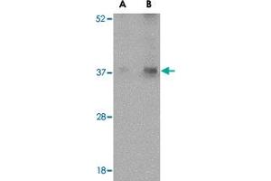 Western blot analysis of EMD in human skeletal muscle tissue lysate with EMD polyclonal antibody  at (A) 0.