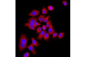 MCF-7 cells were stained with P21 Polyclonal Antibody, Unconjugated at 1:500 in PBS and incubated for two hours at 37°C followed by Goat Anti-Rabbit IgG (H+L) Cy3 conjugated secondary antibody.