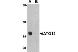 Western Blotting (WB) image for anti-Autophagy Related 12 (ATG12) (Middle Region) antibody (ABIN1030868) (ATG12 antibody  (Middle Region))