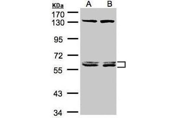 DNAJC7 antibody  (Center)