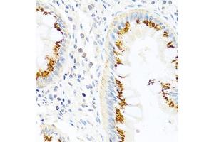 Immunohistochemistry of paraffin-embedded human colon using FB antibody (ABIN3021390, ABIN3021391, ABIN3021392 and ABIN6215001) at dilution of 1:100 (40x lens). (FAM3B antibody  (AA 30-235))