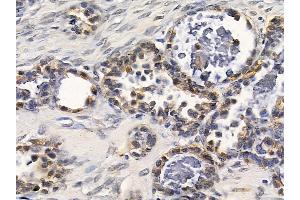 anti-Anoctamin 9 (ANO9) (Internal Region) antibody