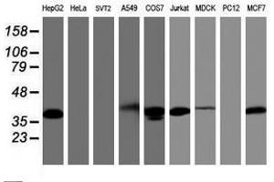 Image no. 3 for anti-PDZ and LIM Domain 2 (PDLIM2) antibody (ABIN1500130) (PDLIM2 antibody)