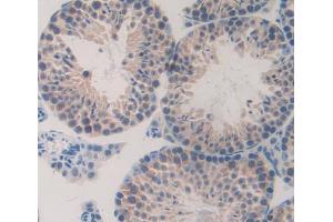 Used in DAB staining on fromalin fixed paraffin- embedded testis tissue (TESK1 antibody  (AA 52-309))