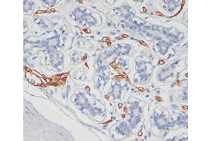 Immunohistochemistry of paraffin-embedded Human breast using CD36 Polyclonal Antibody at dilution of 1:200 (40x lens).