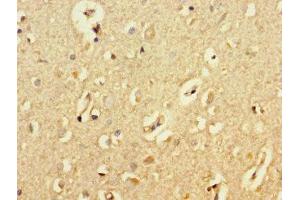 Immunohistochemistry of paraffin-embedded human brain tissue using ABIN7145091 at dilution of 1:100 (ATG5 antibody  (AA 5-272))