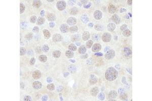 Immunohistochemistry (IHC) image for anti-Chromodomain Helicase DNA Binding Protein 3 (CHD3) (AA 1950-2000) antibody (ABIN7448475) (CHD3 antibody  (AA 1950-2000))