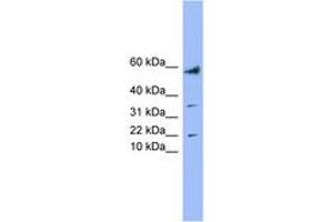 LYRM1 anticorps  (AA 35-84)
