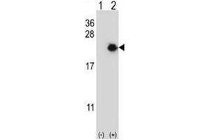Western blot analysis of EIF4EBP1 (arrow) using rabbit polyclonal EIF4EBP1 Antibody (Center) . (eIF4EBP1 antibody  (Middle Region))