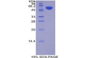 SDS-PAGE analysis of Rat Pregnancy Zone Protein.