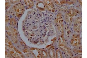 IHC image of ABIN7175288 diluted at 1:200 and staining in paraffin-embedded human kidney tissue performed on a Leica BondTM system.