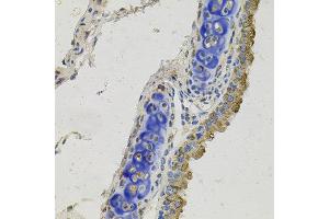 Immunohistochemistry of paraffin-embedded mouse lung using GAS6 antibody at dilution of 1:100 (x40 lens). (GAS6 antibody)