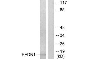 Western Blotting (WB) image for anti-Prefoldin Subunit 1 (PFDN1) (N-Term) antibody (ABIN1849016) (PFDN1 antibody  (N-Term))