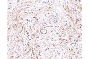 Immunohistochemistry of TEM5 in human bladder tissue with this product at 5 μg/ml. (GPR124 antibody  (Center))