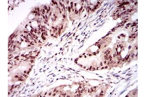 Immunohistochemistry (IHC) image for anti-One Cut Homeobox 3 (ONECUT3) (AA 350-455) antibody (ABIN1724872)