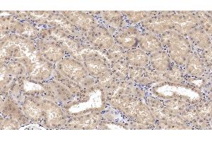 Detection of SHH in Human Kidney Tissue using Monoclonal Antibody to Hedgehog Homolog, Sonic (SHH) (Sonic Hedgehog antibody  (AA 36-193))