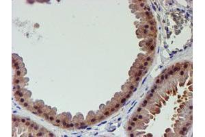 Immunohistochemical staining of paraffin-embedded Human breast tissue using anti-PSMD2 mouse monoclonal antibody. (PSMD2 antibody)