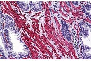 Human Prostate: Formalin-Fixed, Paraffin-Embedded (FFPE) (SMURF1 antibody  (AA 165-269))