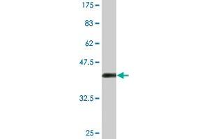 Western Blot detection against Immunogen (36. (HIPK4 antibody  (AA 519-616))