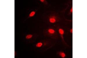 Immunofluorescent analysis of AP2 alpha/beta staining in HepG2 cells. (AP2 alpha/beta (C-Term) antibody)