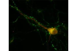 Immunocytochemistry (ICC) image for anti-Early Endosome Antigen 1 (EEA1) (AA 2-13) antibody (ABIN1742484) (EEA1 antibody  (AA 2-13))