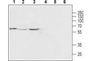 Western blot analysis of human MCF-7 breast adenocarcinoma cell line (lanes 1 and 4), rat heart (lanes 2 and 5) and mouse heart (lanes 3 and 6) lysates: - 1-3. (Mucolipin 2 (MCOLN2) (AA 212-228), (Intracellular), (N-Term) antibody)