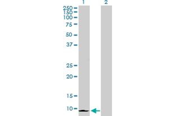 CXCL6 antibody  (AA 1-114)
